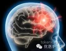 男子晨起洗澡致顱內動脈瘤破裂：健康管理與預防措施的行業洞察