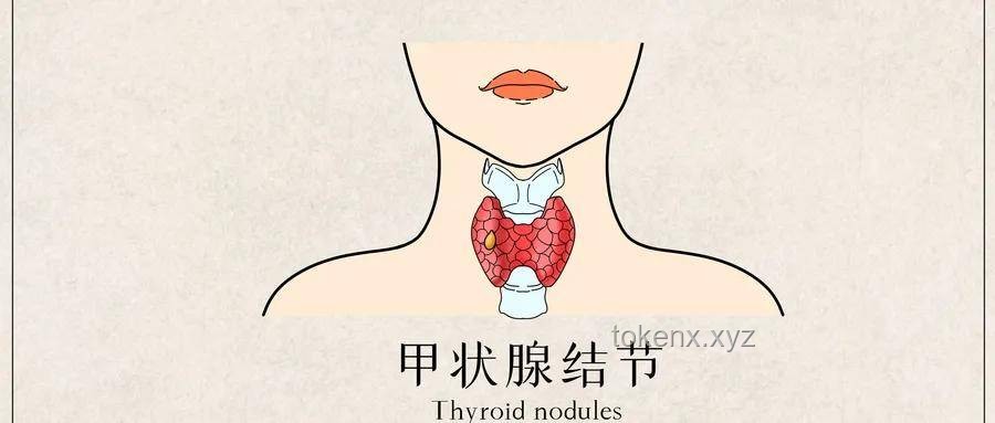 每生一次氣都累積在甲狀腺：情緒健康與甲狀腺疾病趨勢預測
