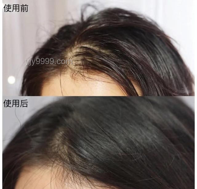 洗頭后這個習慣會加重脫發：避免錯誤干發方式
