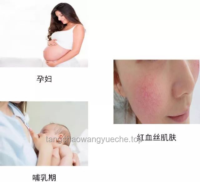 Labubu牙套佩戴與護理指南：輕松掌握，美麗加分