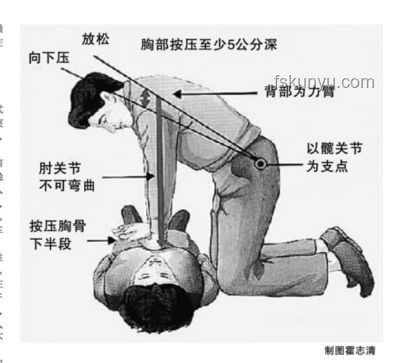 男子運(yùn)動拉伸致肺動脈栓塞險(xiǎn)猝死解決方案