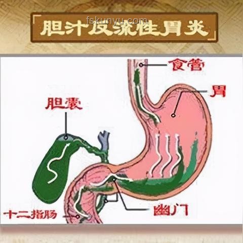 老人誤診胃炎遭全胃切除：醫療行業信任危機與反思