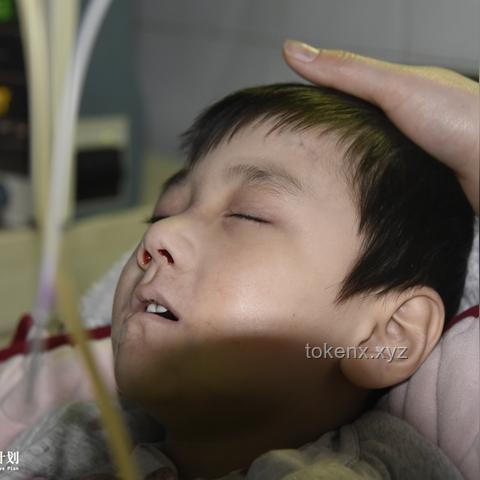 女子輸液過敏轉(zhuǎn)院風(fēng)險預(yù)警：醫(yī)療應(yīng)急體系革新迫在眉睫