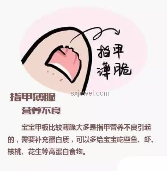 經常做這種夢，小心健康預警！??