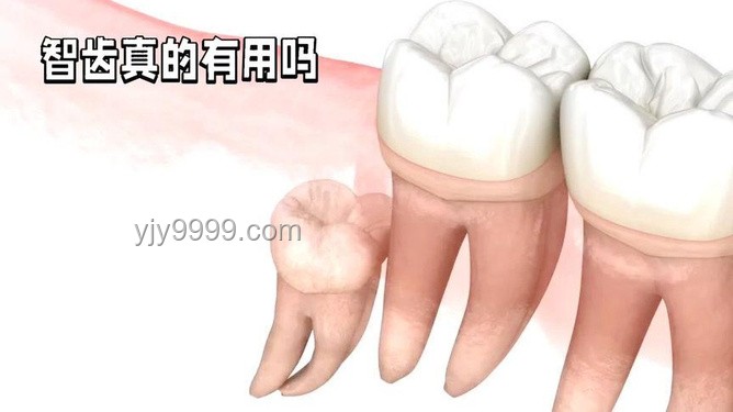 人體之謎：智齒——你身上最沒用的器官，每天還在拼命工作