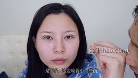 葛薈婕自曝戒酒歷程：手術(shù)背后的勇氣與重生??